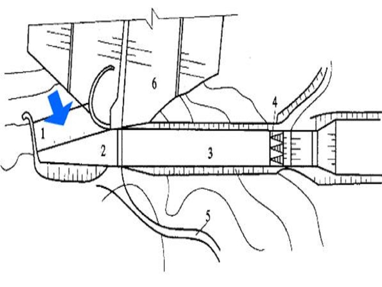 2.侧槽式溢洪道特点:水流过堰后,转向约90°,进入泄水槽.适用:水流