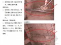 机电安装工程质量通病与预防（图文讲解 CAD示意图）