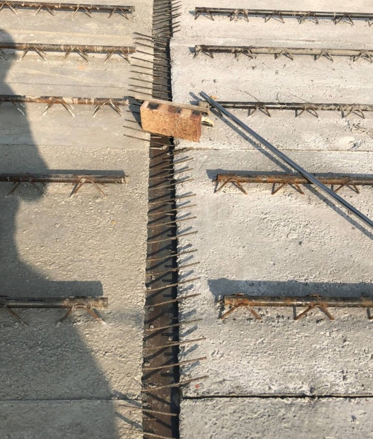 14胡子筋长度不应小于50mm